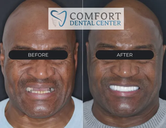 implants-showcase gallery