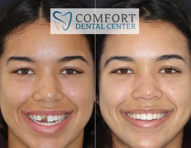 implants-showcase gallery