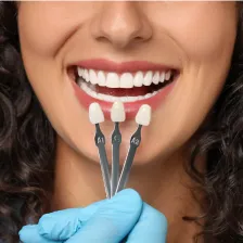 Dental Veneers Services at Comfort Dental Center in Los Angeles, CA