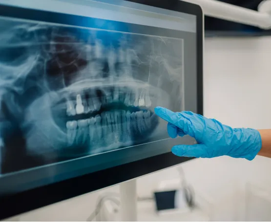 Digital X-Rays at Comfort Dental Center