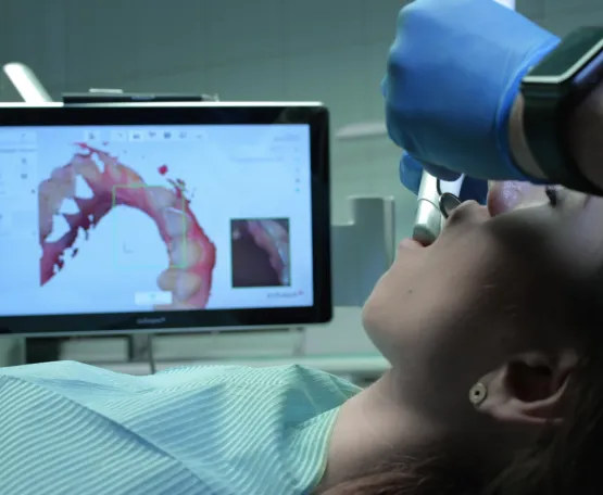 Intra-Oral Camera - Comfortable Mess-Free Impressions at Comfort Dental Center